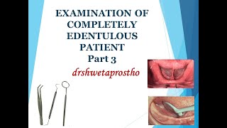 EXAMINATION OF COMPLETELY EDENTULOUS PATIENT PART 3 [upl. by Leiand814]