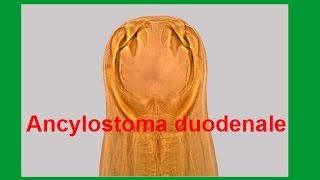 Ancylostoma duodenale [upl. by Ecirtahs]