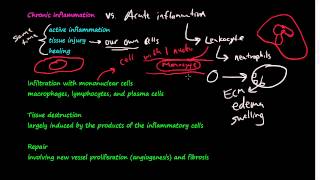 28  Chronic Inflammation  Introduction Macrophages [upl. by Reviere]