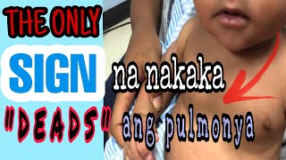 PULMONYA SA BATA ang nakakatakot na senyales na nakakamatay ang UBO at mabilis na paghinga [upl. by Auhsuj]