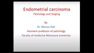 Pathology of endometrial cancer  Typing and staging  Prof Marwa Zaki [upl. by Bettzel]