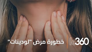 هذه خطورة مرض quotلوديناتquot على الأطفال وتأثيره على الخصوبة الذكور [upl. by Kannan]