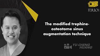 The modified trephineosteotome sinus augmentation technique [upl. by Engis]