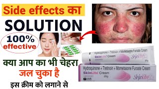 skin light cream के साइड इफेक्ट को ऐसे ठीक करें  skinlite cream side effects ko kaise thik kare [upl. by Nodnerb]