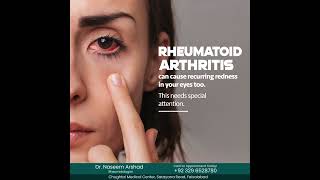 Rheumatoid Arthritis amp Eye Redness What You Need to Know rheumatoidarthritis [upl. by Darwen699]