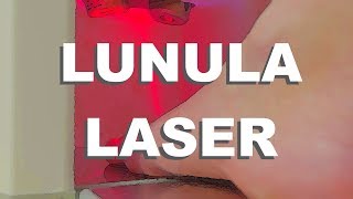 Lunula Laser  Fungal Infection Removal With Lasers [upl. by Iey345]