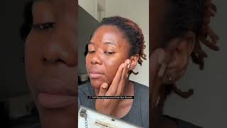 Eliminate Dark Spots and Hyperpigmentation with UltraPotent Brightening Serum [upl. by Eirelav104]