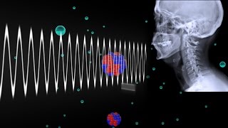 How Do Xrays Work [upl. by Eatnoed]