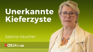 Unerkannte Zyste im Kiefer Folgen für den Organismus  Zahnärztin Sabine Vaucher  QS24 [upl. by Longmire83]