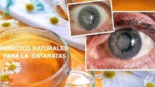 REMEDIOS Naturales PARA LAS CATARATAS [upl. by Ahtreb]