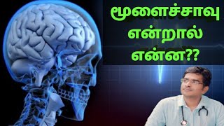 மூளைச் சாவு என்றால் என்ன examination in detailmedical awareness in Tamil [upl. by Dirgni159]