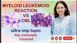 LEUKEMIACML vs LEUKEMOID REACTION VIMP topic for ugpg neetpg inicet pathologyconcepts [upl. by Oigroeg]