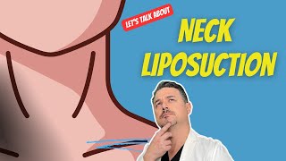 Double Chin Surgery  liposuction [upl. by Cassandre]