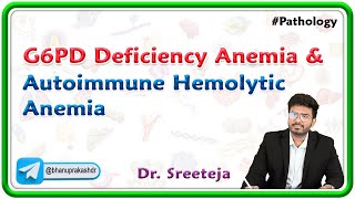 8 G6PD Deficiency Anemia amp Autoimmune Hemolytic Anemia  USMLE Step 1 [upl. by Arrimat]