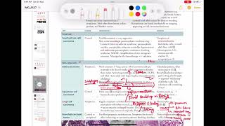 Adenocarcinoma Respiratory 54  First Aid USMLE Step 1 in UrduHindi [upl. by Eimma297]