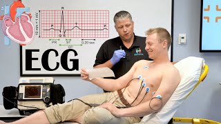 What Is ECG ElectrocardiogramEKG Indications How It Is Done And Basic Principles [upl. by Araid]