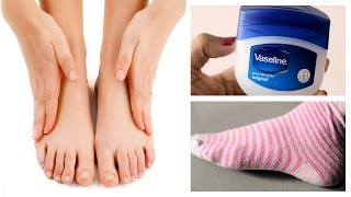 How to Get Super Soft Feet Using Vaseline [upl. by Beckie529]