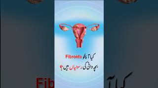 Transform Your Life The Ultimate Solution for Fibroids amp Adenomyosis [upl. by Nahtanaj]