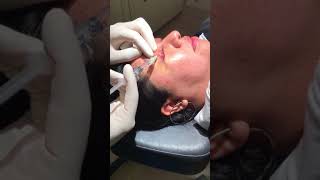 Part I Video of Chalazion and Scar Tissue Removal [upl. by Shifra]