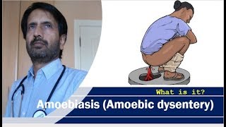 Amoebiasis Amoebic dysentery  Symptoms of dysentery [upl. by Benni]