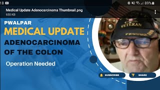 Adenocarcinoma of the Colon Pwalpar Medical Update [upl. by Latsirc262]