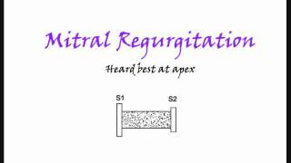 Mitral regurgitation also Tricupsid regurgitation heart murmur [upl. by Lizbeth]