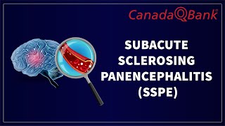 Subacute Sclerosing Panencephalitis SSPE [upl. by Akiehs]