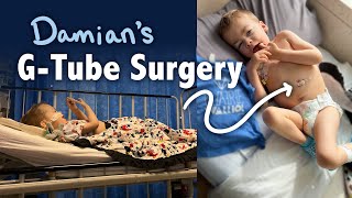 Damians GTube Surgery amp our hospital life [upl. by Cleo372]