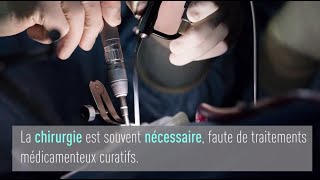 Syndrome et maladie de Cushing  réduire les complications chirurgicales [upl. by Peoples]