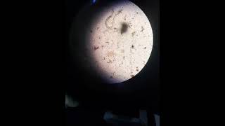 Microscopic examination [upl. by Kitty]