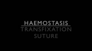 Haemostasis  Transfixation suture [upl. by Demahom706]