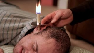 The danger of ear candling [upl. by Aday]