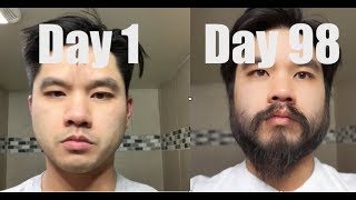 I Grew Out My Beard For 3 Months Using Minoxidil Rogaine [upl. by Astraea]