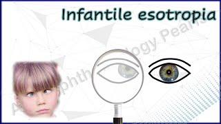 Infantile Esotropia Simplified 1│Understanding Various Phenomena amp Differential Diagnosis [upl. by Skutchan613]