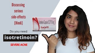 Do you need IsotretinoinAccutane for severe acneBefore and after sideeffects Hindi [upl. by Allak685]