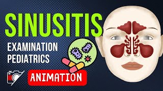 WHAT IS RHINO  SINUSITIS   Pediatrics  Anatomy  Development  Definitions  Animation [upl. by Crompton]