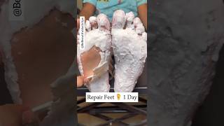 ✅Repair cracked feet in 1 dayget rid of cracked heels shorts youtubeshorts viral [upl. by Kciderf]