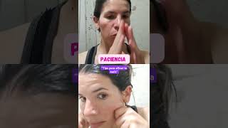 quotTips para afinar la narizquot argentina🇦🇷 mdp masajefacial CUIDADODELAPIEL 💯🌱🍃😊 [upl. by Blondelle]