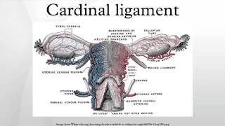 Cardinal ligament [upl. by Horbal]