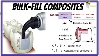 BULKFILL Composites  How is depth of cure increased What is SONIC ACTIVATED Bulkfill [upl. by Aes]