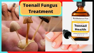 Natural Tonail Fungus Cure and Athletes Foot Cure Natural Fungus Killer by Nicoles Heart [upl. by Yttig448]