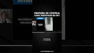 Como identificar uma fratura de costela no RX ⚡ [upl. by Erdnaed]