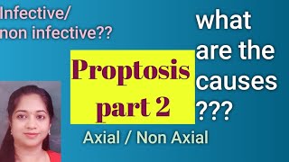 Classification and causes of Proptosis  Axial or non axial proptosis [upl. by Htebazileharas717]