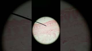 Meissners and Pacinian corpuscle histology [upl. by Anitaf746]