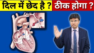 Can Congenitalbirth Heart Disease Be Cured [upl. by Trainer337]