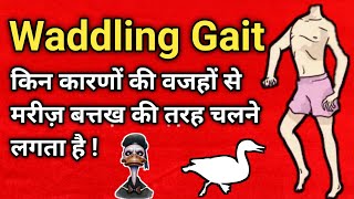 waddling gait explained in hindi  duck like walk  abnormal gait pattern [upl. by Nnylaehs623]