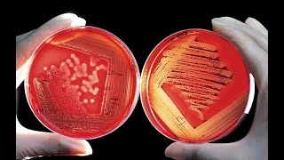 🦠Po jakim czasie probiotyk który ma 2 mld bakterii w kapsułce odbuduje florę jelitową❓ Obliczyłem❗ [upl. by Ayerhs649]