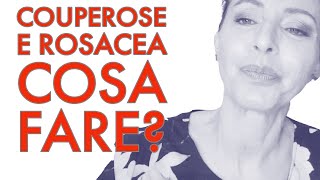 Couperose e Rosacea cosa fare⁉️Pelli sensibili [upl. by Llimaj40]