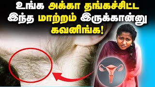 PCOD amp PCOS Symptoms amp Treatment in Tamil ஆண்பெண் தெரிந்து கொள்ளவேண்டிய பெண்களை பற்றிய விஷயங்கள் [upl. by Noid]