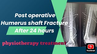 POST OPERATIVE HUMERUS FRACTURE AFTER 24HR  PHYSIOTHERAPY TREATMENT EXERCISE [upl. by Naman]